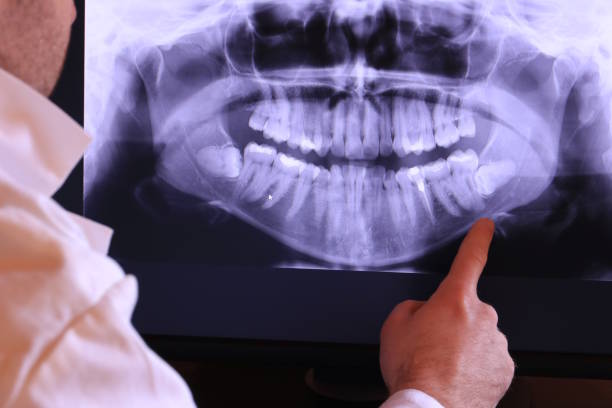 Professional Emergency Dentist in NC