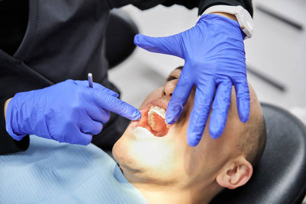 Best Emergency Wisdom Teeth Removal in Waxhaw, NC
